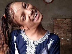 Cerita Perjuangan Remaja Putri yang Lehernya Bengkok 90 Derajat