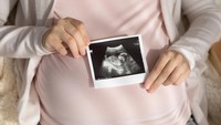 6 Jenis USG untuk Memeriksa Kondisi Janin Sesuai dengan Kebutuhan Bumil