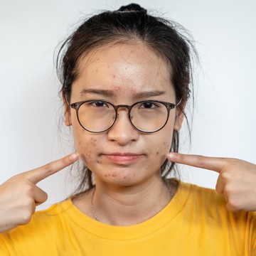 img-title Alasan Kenapa Stres Bisa Pengaruhi Kesehatan dan Kecantikan Kulit, Berikut Penjelasannya