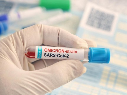 COVID-19 Melonjak di Singapura, Ada Subvarian Omicron Baru XBB