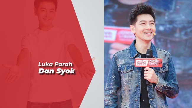 Jimmy Lin Kecelakaan dengan Anaknya, Mobil Tabrak Tiang hingga Terbakar