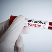 Banyak yang Sudah Melaporkan Kasus Cacar Monyet, Termasuk Negara Tetangga, IDI Minta Semua Dokter Waspada