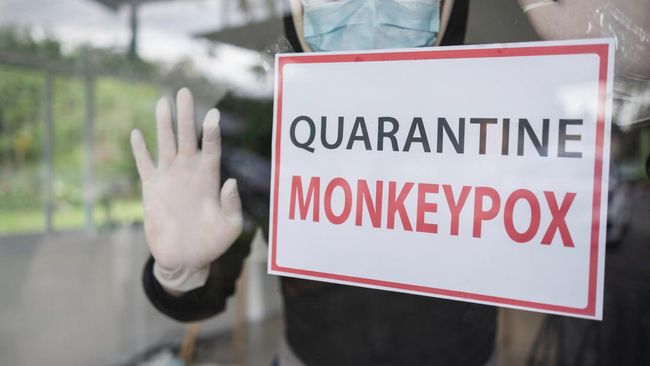 WHO menyatakan wabah cacar monyet sebagai keadaan Darurat Kesehatan Global. Berikut 5 fakta mengenai cacar monyet yang perlu Anda ketahui.
