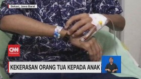 VIDEO: Kondisi Anak di Ikat Rantai, Mulai Membaik