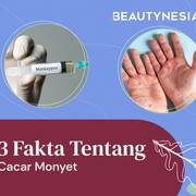 3 Fakta Tentang Cacar Monyet