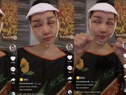 Kapoknya Lucinta Luna, Gegara Seafood Luka Operasi Khodam Jadi Seperti Ini