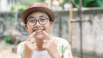 KAPAN ANAK BOLEH PAKAI RETAINER DAN BEHEL?