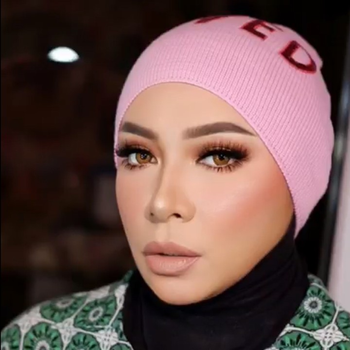 <p>Melly kemudian mendapatkan saran dari Tompi untuk melakukan operasi bariatrik. Operasi itu berjalan dengan lancar, Bunda. Melly juga telah menjalani proses pemulihan. (Foto: Instagram @melly_goeslaw)</p>