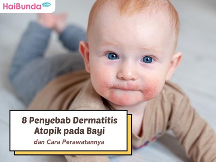 8 Penyebab Dermatitis Atopik pada Bayi dan Cara Perawatannya