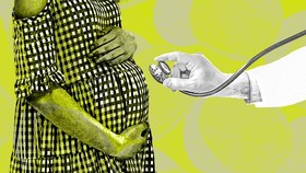 Mengenal Jampersal, Layanan Melahirkan Gratis Bagi Ibu Hamil