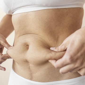 img-title Studi: Lemak Perut pada Perempuan Ternyata Lebih Berbahaya, Kok Bisa? Ini Penjelasannya
