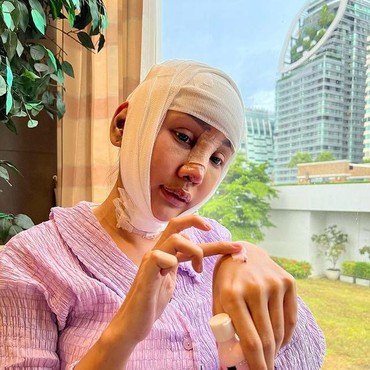 Pengalaman Lucinta Luna Saat Operasi Rahang: Sakitnya Kayak Sakaratul Maut
