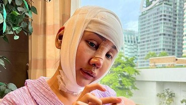 img-title Pengalaman Lucinta Luna Saat Operasi Rahang: Sakitnya Kayak Sakaratul Maut