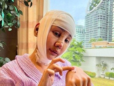 img-title 7 Potret Lucinta Luna Ngaku Jalani Oplas di Korea Selatan Jadi Sorotan