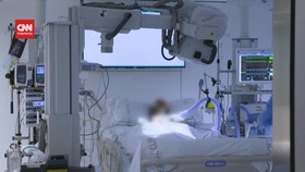 VIDEO: Pasien Cacar Monyet Meninggal Dunia di Spanyol dan Brazil