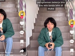 Asal Usul Tanda Lahir, Jadi Alasan Viral Pria Ditolak Kerja