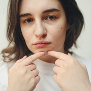 Urutan Mandi Bisa Menyebabkan Munculnya Jerawat, Lho Kok Bisa?