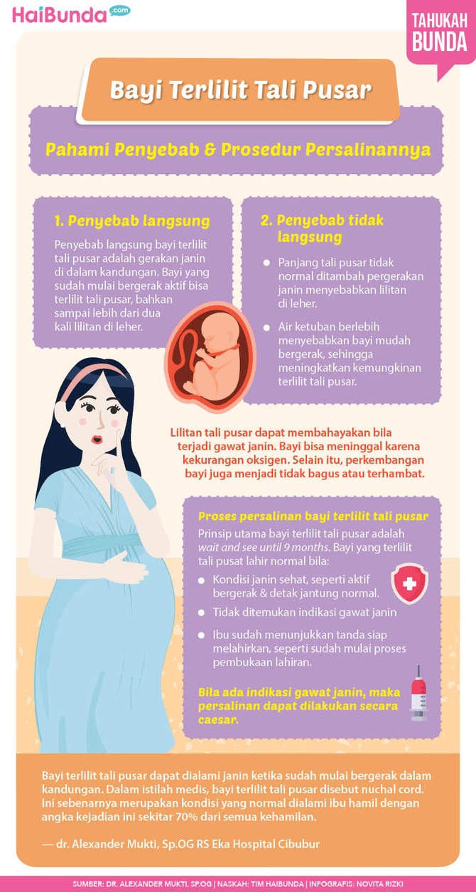 Bayi terlilit pusar Bayi terlilit pusar