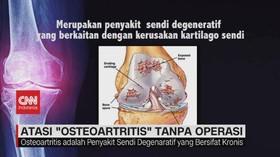 VIDEO: Atasi 'Osteoartritis' Tanpa Operasi