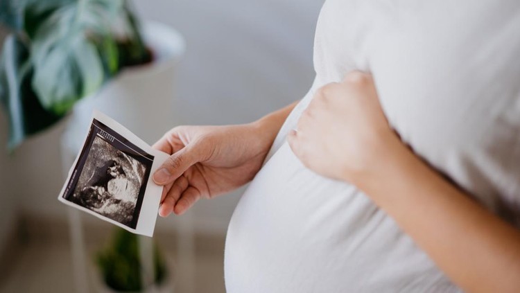 Image of an Asian pregnant woman holding ultrasound baby scan image