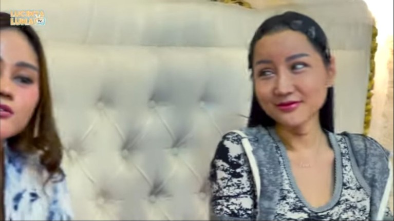 Lucinta Luna akhirnya menunjukkan wajah usai operasi plastik.