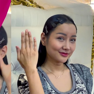 Wajah Hasil Oplas Tak Sesuai dengan Harapan Warganet, Lucinta Luna Ngamuk!
