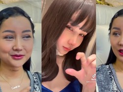 Sederet Bedah Plastik yang Dijalani Lucinta Luna: Ganti Kepala sampai Potong Leher