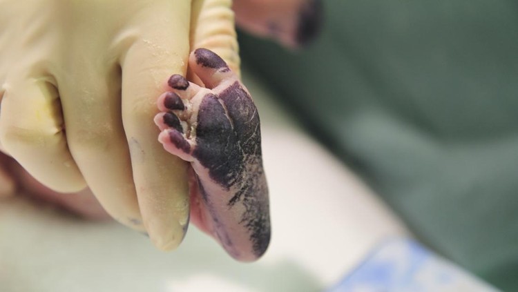 Ilustrasi Cap Kaki Bayi newborn baby foot close-up right after taking footprints during delivery