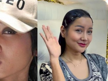 img-title 9 Transformasi Lucinta Luna dari Awal hingga Oplas Ngaku Mirip Idol Korea