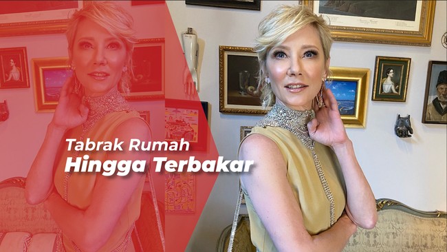 Anne Heche Masih Koma Usai Alami Kecelakaan Mobil di Los Angeles