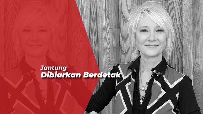 Alami Mati Otak, Aktris Anne Heche Dinyatakan Meninggal Dunia