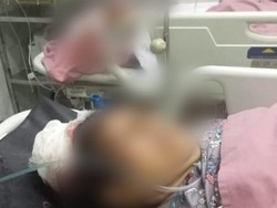 2 dari 5 Korban Pembacokan Satu Keluarga di Bandar Lampung Masih Kritis