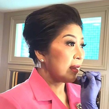 Apa Itu Malingering atau Pura-pura Sakit yang Dilakukan Istri Ferdy Sambo?