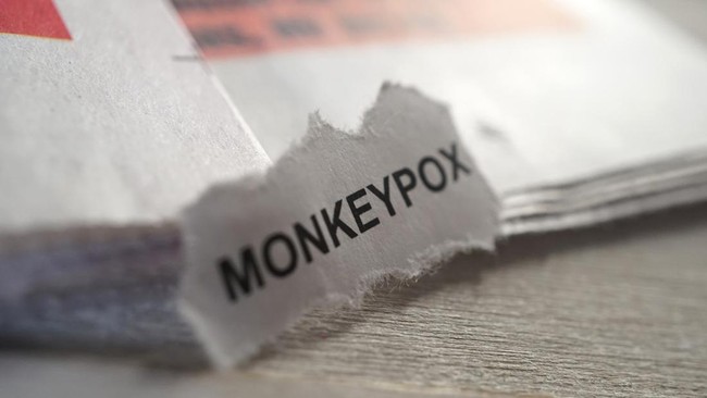 Kemenkes RI kembali menemukan kasus cacar monyet di Indonesia. Masyarakat bisa mewaspadai beberapa gejala awal cacar monyet berikut ini.