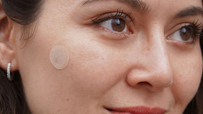 BeauPicks: 4 Pilihan Acne Patch untuk Mengatasi Jerawat, Harga Mulai dari Rp20 Ribuan