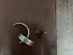 Dua Jam Bikin Ngilu! Evakuasi Cincin dari Mr P Pria di Sidoarjo