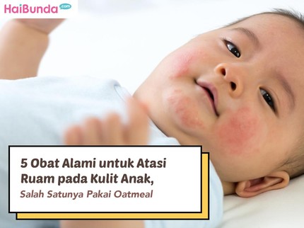 5 Obat Alami untuk Atasi Ruam pada Kulit Anak, Salah Satunya Pakai Oatmeal