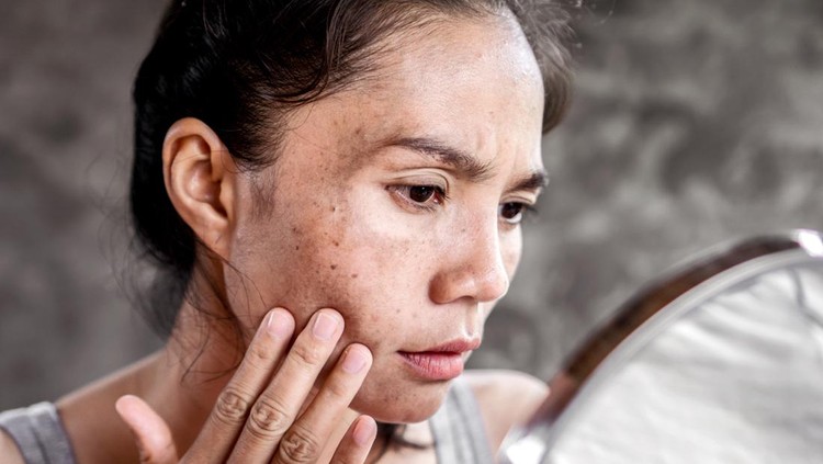 Purging Asian woman having skin problem checking her face with dark spot, freckle from UV light in mirror