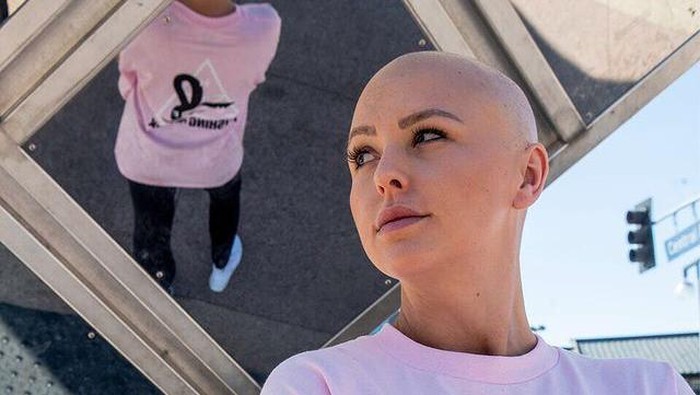 Ditolak mammografi 2 Kali Berujung Kanker Stadium 4/Instagram/@philecia