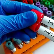 Kasus HIV di Kalangan Remaja Tulungagung Meningkat, Penyebabnya Pergaulan Bebas hingga Kurang Edukasi Seks