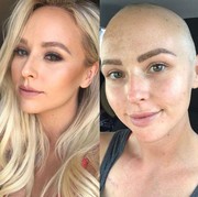 Terlambat Kenali Gejala, Klinik Sebut Perempuan Ini Baik-baik Saja, Padahal Idap Kanker Stadium 4! Ini Kisahnya