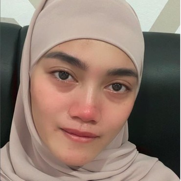Selebgram Jess Amalia Bawa Kabar Duka