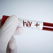 Tuai Kontroversi, Wagub Jabar Sebut Nikah-Poligami Jadi Solusi untuk Cegah HIV/AIDS, Terbaru Sampaikan Permintaan Maaf