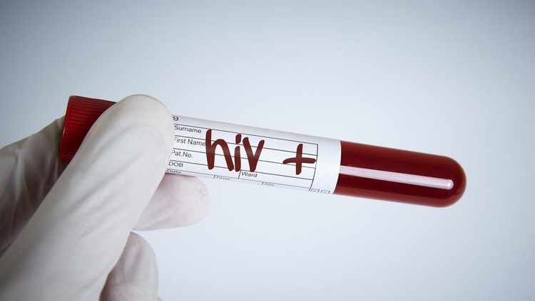 Laboratory Request, Hiv Test, Hiv Positive