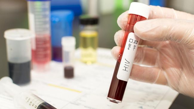 Komitmen IDI dalam Mencegah Penyakit Menular Tertuang dalam Hari Tes HIV Nasional