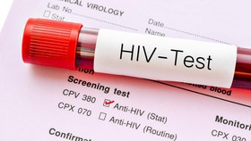 Kenali Jenis-jenis Tes HIV, Apa Bedanya dan Siapa yang Perlu?