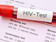 6 Cara Tes HIV di Rumah Sakit, Ada Antigen dan PCR