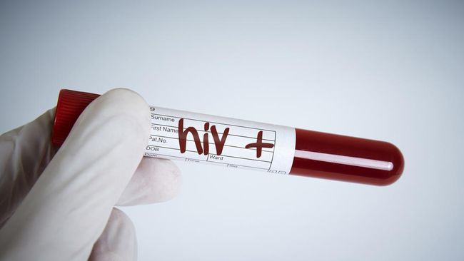 Menurut Kemenkes, sebesar 33 persen ibu rumah tangga bisa terkonfirmasi positif HIV karena terpapar dari pasangan yang memiliki perilaku seks berisiko.