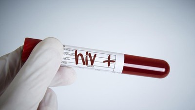 Penanganan HIV/AIDS di RI, Belum Semua Pasien Dapat Akses Obat
