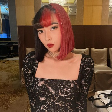 Mengenal Autoimun SLE yang Dialami Isyana Sarasvati